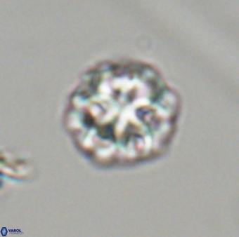 Olladiscoaster perplexus 32417