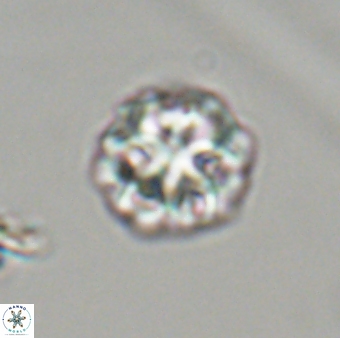 Olladiscoaster perplexus 32417