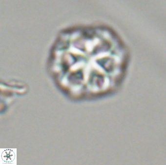 Olladiscoaster perplexus 32418