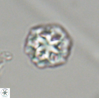 Olladiscoaster perplexus 32419