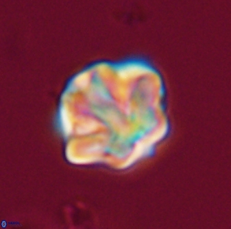 Olladiscoaster perplexus 32469