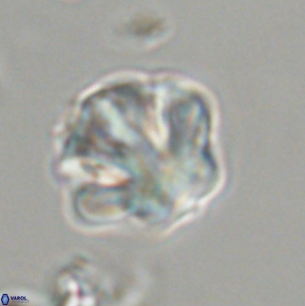 Olladiscoaster perplexus 32471