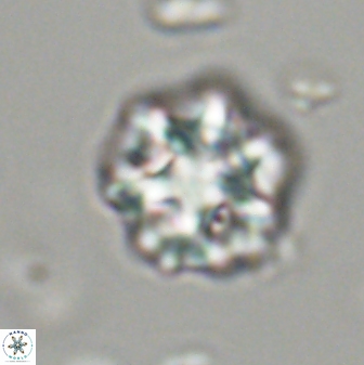 Olladiscoaster perplexus 32473