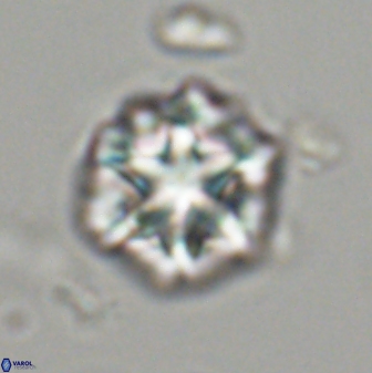 Olladiscoaster perplexus 32474