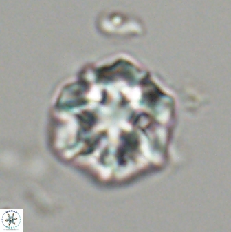Olladiscoaster perplexus 32475