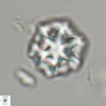 Olladiscoaster perplexus 32476