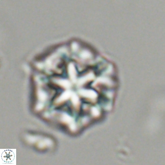 Olladiscoaster perplexus 32477