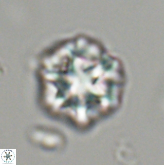 Olladiscoaster perplexus 32478