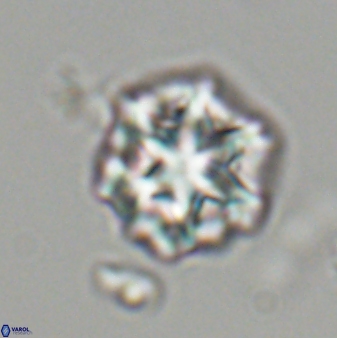 Olladiscoaster perplexus 32479