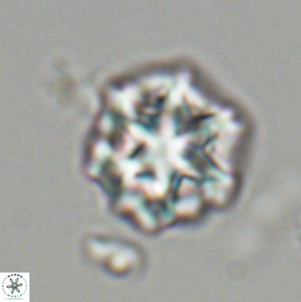 Olladiscoaster perplexus 32479
