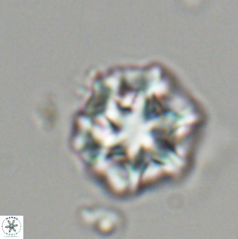 Olladiscoaster perplexus 32480