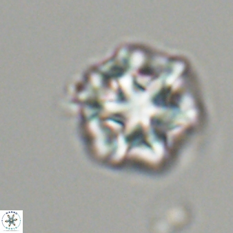 Olladiscoaster perplexus 32485