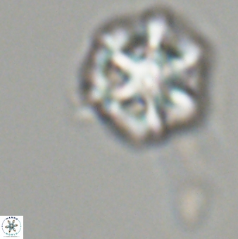 Olladiscoaster perplexus 32486