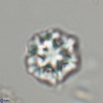 Olladiscoaster perplexus 32487