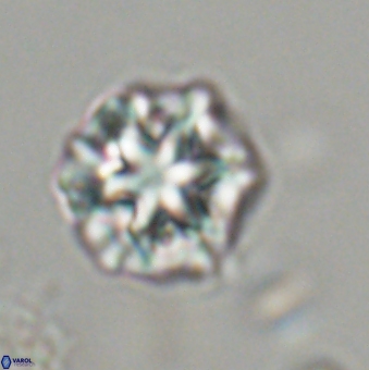 Olladiscoaster perplexus 32488