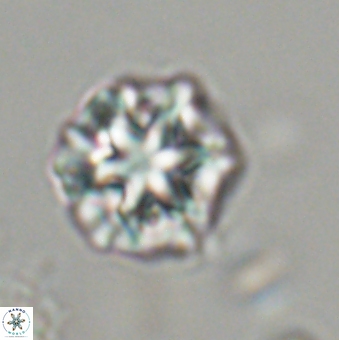 Olladiscoaster perplexus 32488