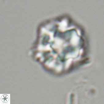 Olladiscoaster perplexus 32491
