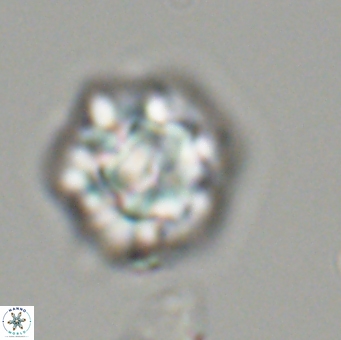 Olladiscoaster perplexus 32493