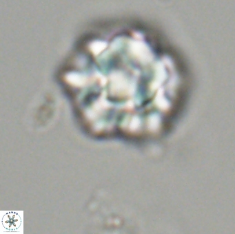 Olladiscoaster perplexus 32494