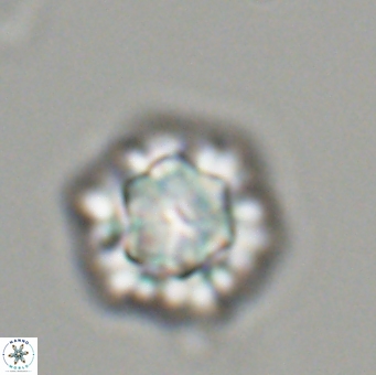 Olladiscoaster perplexus 32495