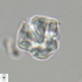 Olladiscoaster perplexus 32499