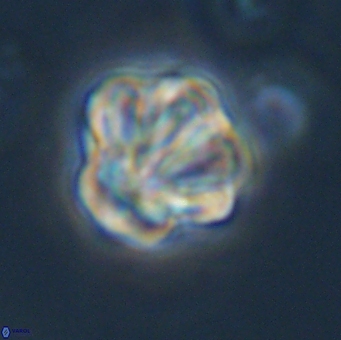 Olladiscoaster perplexus 32500