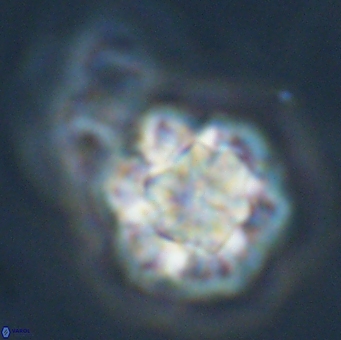 Olladiscoaster perplexus 32503