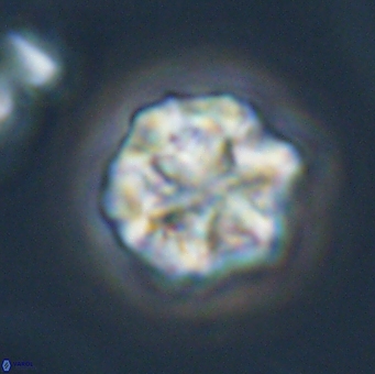 Olladiscoaster perplexus 32510