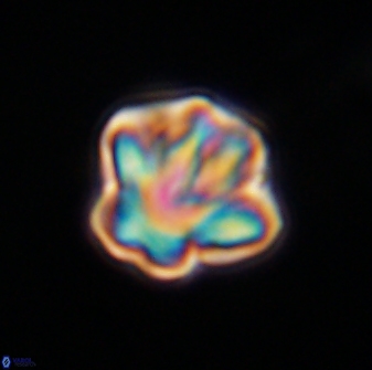 Olladiscoaster perplexus 32511