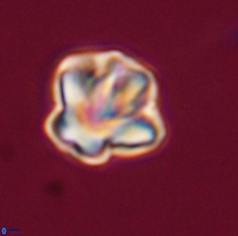 Olladiscoaster perplexus 32513