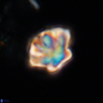 Olladiscoaster perplexus 32574