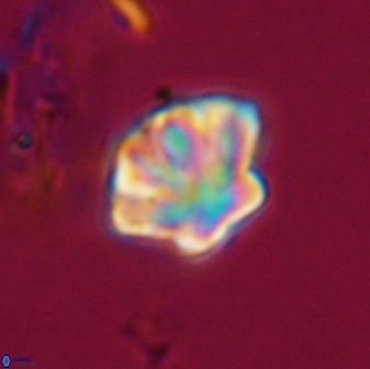 Olladiscoaster perplexus 32575