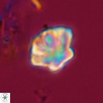Olladiscoaster perplexus 32575