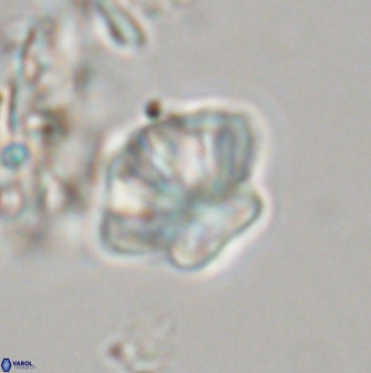 Olladiscoaster perplexus 32576
