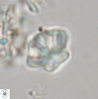 Olladiscoaster perplexus 32576