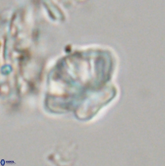 Olladiscoaster perplexus 32577