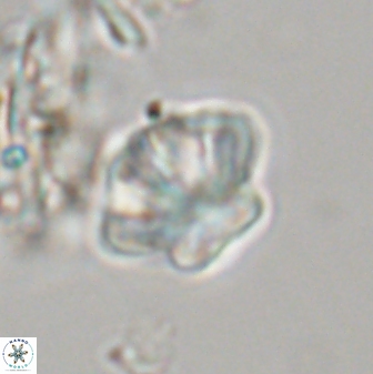 Olladiscoaster perplexus 32577