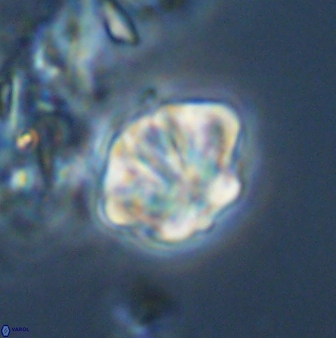 Olladiscoaster perplexus 32578