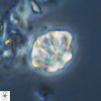 Olladiscoaster perplexus 32578