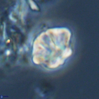 Olladiscoaster perplexus 32579