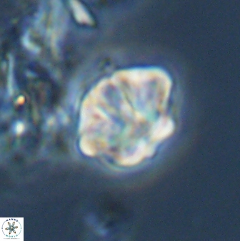 Olladiscoaster perplexus 32579