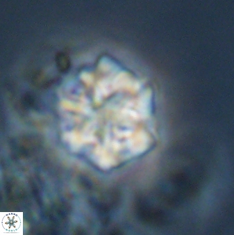 Olladiscoaster perplexus 32581