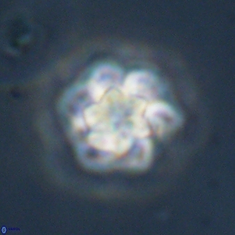 Olladiscoaster perplexus 32582