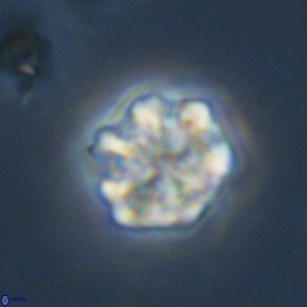 Olladiscoaster perplexus 32584