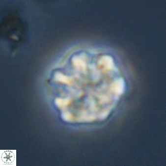 Olladiscoaster perplexus 32584