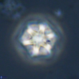 Olladiscoaster perplexus 32585