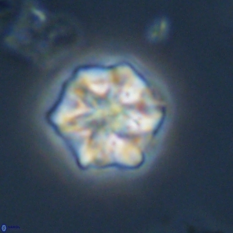 Olladiscoaster perplexus 32588