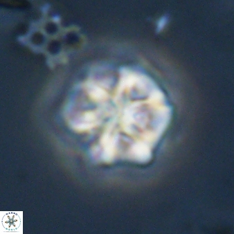 Olladiscoaster perplexus 32589