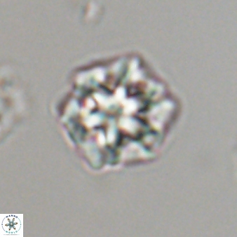 Olladiscoaster perplexus 32593