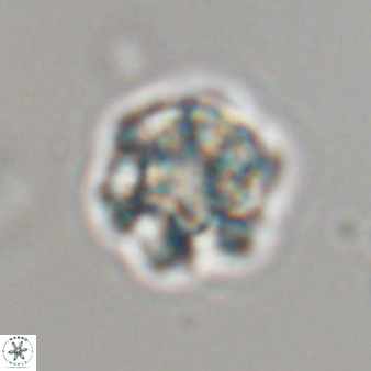 Olladiscoaster perplexus 32595